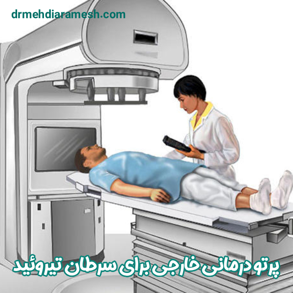 پرتو درمانی خارجی سرطان تیروئید - دکتر مهدی آرامش