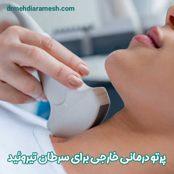 پرتو درمانی خارجی سرطان تیروئید - دکتر مهدی آرامش