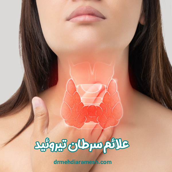 علائم سرطان تیروئید - دکتر مهدی آرامش