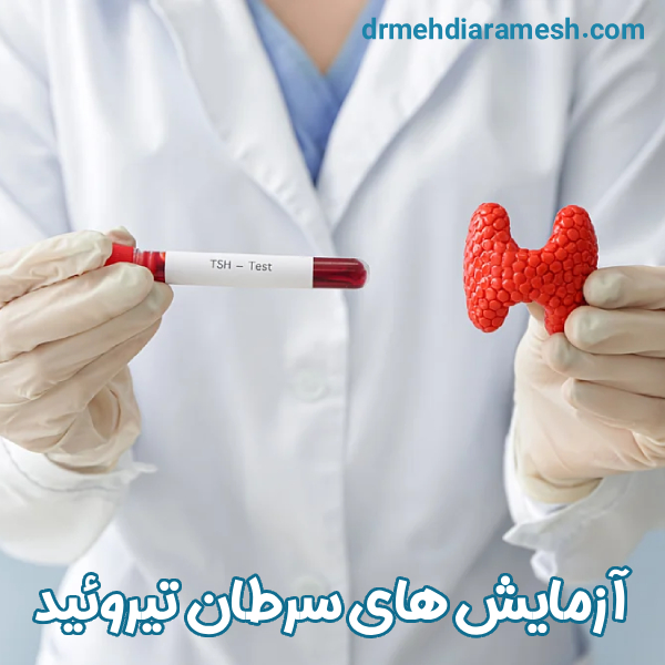 آزمایش های سرطان تیروئید - دکتر مهدی آرامش