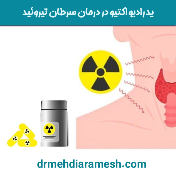 ید رادیو اکتیو در درمان سرطان تیروئید - دکتر مهدی آرامش