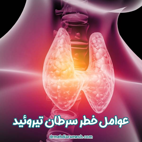 عوامل خطر سرطان تیروئید | دکتر مهدی آرامش