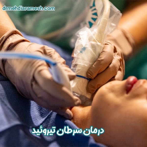 درمان سرطان تیروئید - دکتر مهدی آرامش
