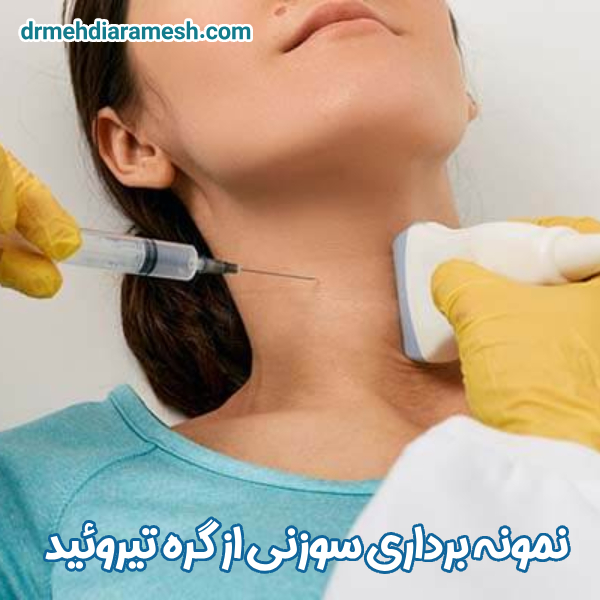 نمونه‌ برداری سوزنی از گره تیروئید - دکتر مهدی آرامش
