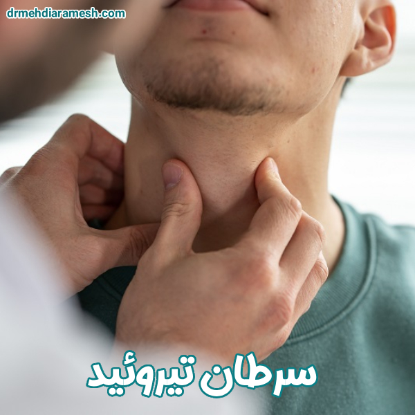 سرطان تیروئید - دکتر مهدی آرامش