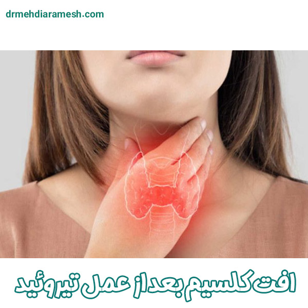 افت کلسیم بعد از عمل تیروئید - دکتر مهدی ارامش