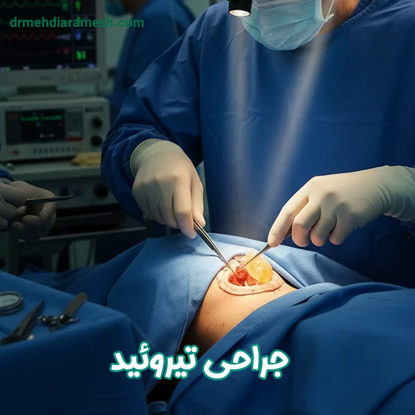 جراحی تیروئید - دکتر مهدی آرامش